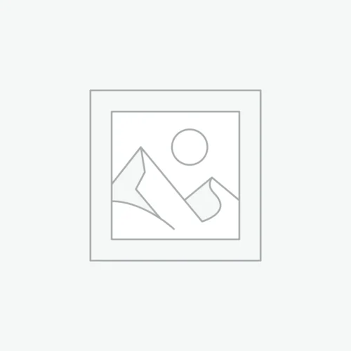 Audi A4 2.0 TDI Engine